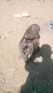 Our Projects in Madagascar Are in Great Need (Graphic Photo Warning)